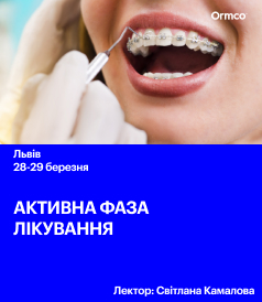 Активна фаза лікування