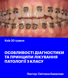 Особливості діагностики та принципи лікування патології 3 класу