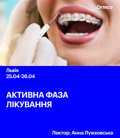 Активна фаза лікування