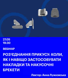 Роз'єднання прикусу