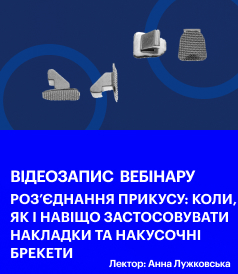 Роз'єднання прикусу