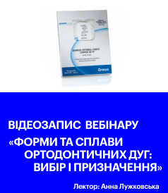 Форми та сплави ортодонтичних дуг: вибір і призначення