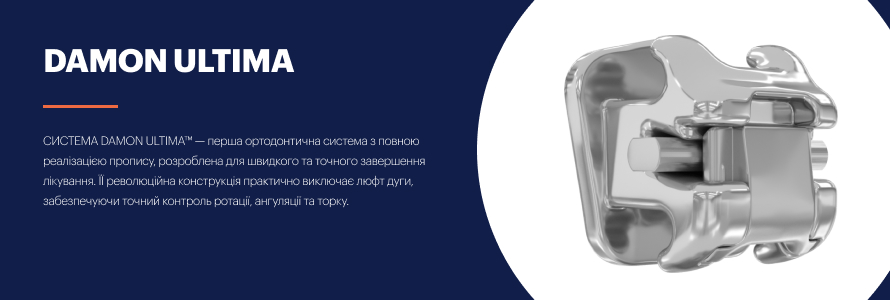 Брекеті Damon Ultima